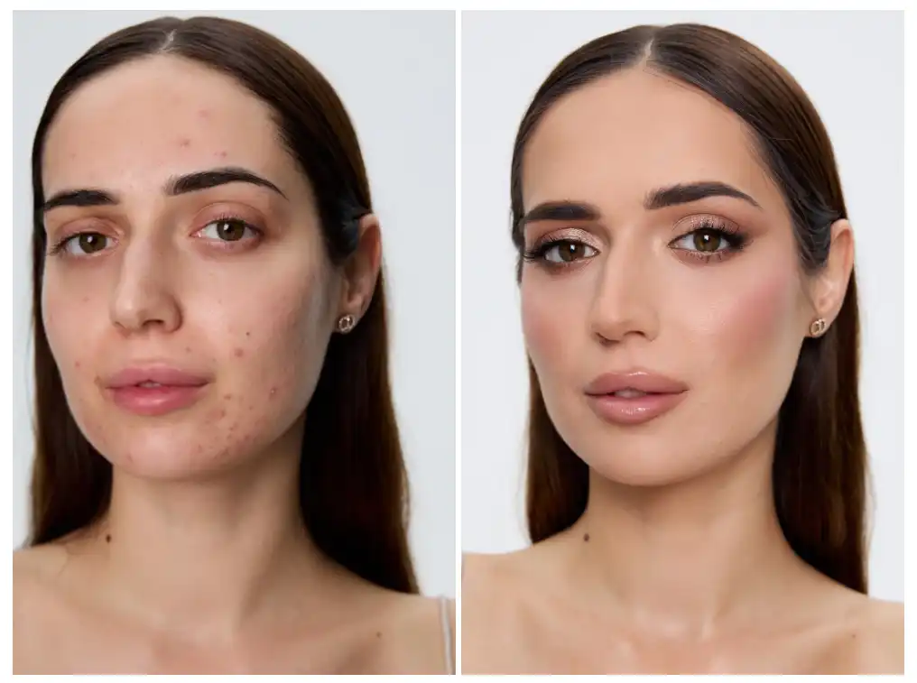 Masterclass Online Cera Problematyczna NOWOŚĆ - obrazek 2